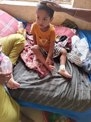 লক্ষ্মীপুরে হামের প্রাদুর্ভাব: ২৪ ঘণ্টায় ১৯ শিশু ভর্তি, মোট আক্রান্ত ৫৮