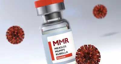 হামের প্রাদুর্ভাব মোকাবিলায় চার সিটিতে বিশেষ টিকাদান কার্যক্রম শুরু