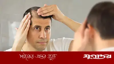 ডিএইচটি হেয়ার লস: চুল পড়ার জেনেটিক কারণ ও সমাধান