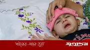 শিশুর হাম: লক্ষণ, চিকিৎসা ও সতর্কতা নিয়ে বিশেষজ্ঞের পরামর্শ