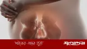 যমজ গর্ভধারণ: কারণ, লক্ষণ ও করণীয় সম্পর্কে বিস্তারিত জানুন