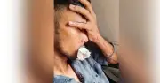 কক্সবাজার এক্সপ্রেসে পাথর নিক্ষেপে দুই যাত্রী আহত, একজনের চার দাঁত ভাঙল