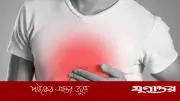বুকজ্বালা কমায় যে ৭ খাবার, জানুন বিশেষজ্ঞের পরামর্শ