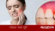 মাড়ির ছোট সমস্যা বড় রোগের ইঙ্গিত হতে পারে