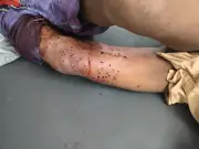 চট্টগ্রামে সন্ত্রাসীদের গুলিতে আহত চারজন, পুলিশ পাঁচজন আটক