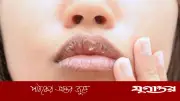 গ্রীষ্মকালেও ঠোঁট ফাটার সমস্যা: বিশেষ যত্নের সহজ উপায়