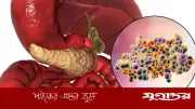 অগ্ন্যাশয় ক্যান্সার চিকিৎসায় যুগান্তকারী আবিষ্কার: নতুন ট্যাবলেটে মৃত্যুঝুঁকি ৬০% কমে