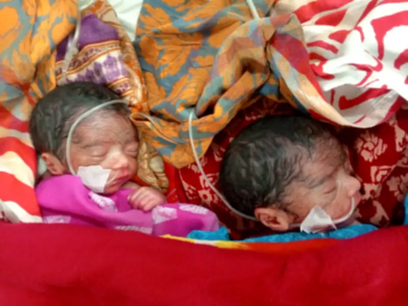 রাজশাহীতে দুই জমজ শিশুর শরীরে অ্যান্টিবায়োটিকের কার্যকারিতা হারানোর আশঙ্কা