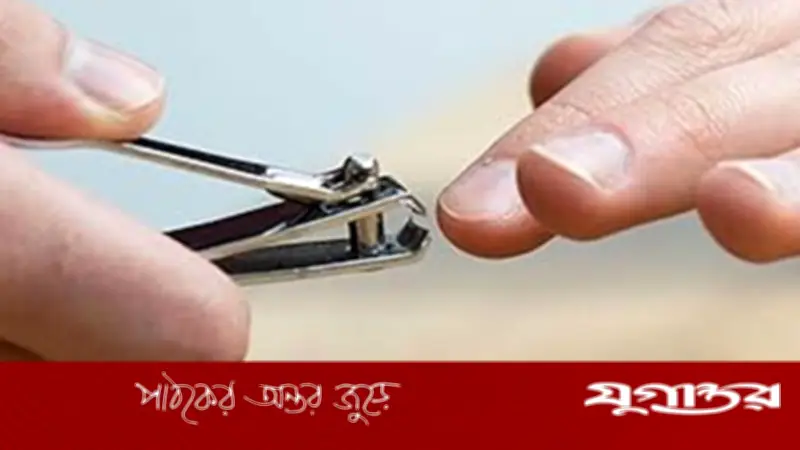 কুরবানির আগে নখ ও চুল না কাটা: ইসলাম কী বলে?