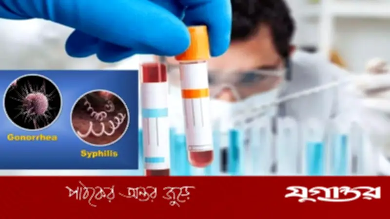 ইউরোপে রেকর্ড হারে বাড়ছে সিফিলিস-গনোরিয়া, আক্রান্তের সংখ্যায় শীর্ষে স্পেন