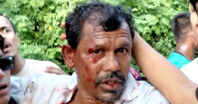 টেকনাফে সালিশি বৈঠকে ইউপি সদস্যের ওপর হামলা, গুরুতর আহত
