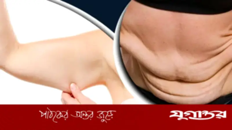 ওজন কমলে ত্বক ঝুলে যাওয়ার সমস্যা ও সমাধান