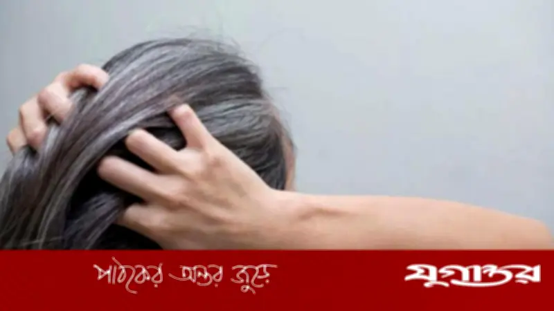 অকালে চুল পাকা রোধে ৪টি কার্যকরী খাবার