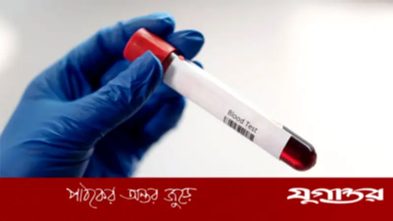 বিয়ের আগে রক্ত পরীক্ষা বাধ্যতামূলক করার আইন চান মন্ত্রী