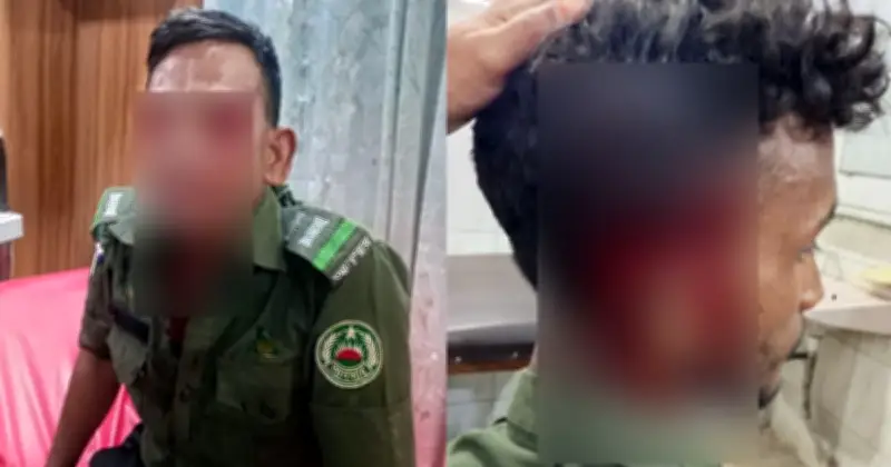 সাভারে হকারদের হামলায় আনসার সদস্যদের চোখ ও মাথায় গুরুতর আঘাত