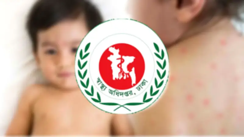 পাকিস্তানে একদিনে হামে ৯ শিশুর মৃত্যু, স্বরাষ্ট্রমন্ত্রীর সাথে পররাষ্ট্র প্রতিমন্ত্রীর বৈঠক