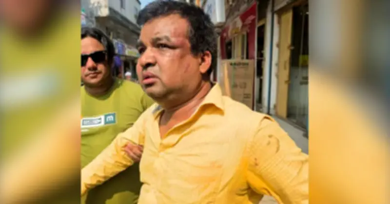 ভুয়া সন্দেহে ভ্যাট পরিদর্শককে বেঁধে মারধর, আহত ২