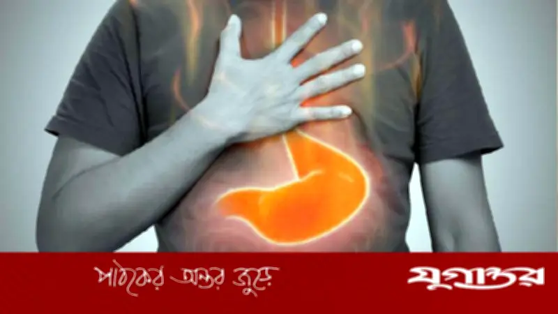 গরমে হালকা খাবারেও পেট ভার? ৫ ভুলে বাড়ে গ্যাস-অম্বল