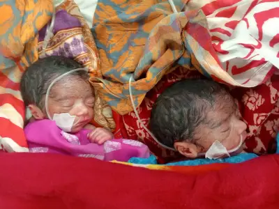রাজশাহীতে দুই জমজ শিশুর শরীরে অ্যান্টিবায়োটিকের কার্যকারিতা হারানোর আশঙ্কা
