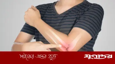 নারীদের হাড় দুর্বল হওয়ার বয়স, কারণ ও প্রতিকার