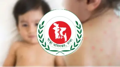 পাকিস্তানে একদিনে হামে ৯ শিশুর মৃত্যু, স্বরাষ্ট্রমন্ত্রীর সাথে পররাষ্ট্র প্রতিমন্ত্রীর বৈঠক