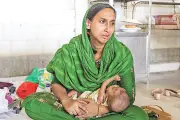 হামে ৪২৪ মৃত্যু, ৪০% শিশু হাসপাতালে আসার দুই দিনেই মারা যাচ্ছে
