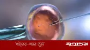এআই প্রযুক্তিতে পুরুষ বন্ধ্যাত্ব দূর করার নতুন আশা