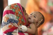 হামে আক্রান্ত শিশুর স্নায়বিক ঝুঁকি ও শিশু বিকাশ কেন্দ্রের সংকট