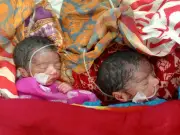 অ্যান্টিবায়োটিক প্রতিরোধী যমজ শিশু, দুশ্চিন্তায় মা-বাবা
