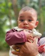 হামে আক্রান্ত হয়ে সাত মাসের শিশুর মৃত্যু, বাড়ছে শঙ্কা