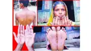 রক্ত পরীক্ষায় আর্সেনিক দূষণ নির্ণয়ে যুগান্তকারী আবিষ্কার