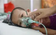 হামে আরও ১৭ শিশুর মৃত্যু, মৃতের সংখ্যা ৫৪৫