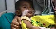 দেশে হামের ভয়াবহ প্রাদুর্ভাব: ৩২ হাজার আক্রান্ত, ২৫০ জনের বেশি মৃত্যু