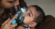 ২৪ ঘণ্টায় হামে আরও ১২ শিশুর মৃত্যু, আক্রান্ত ১,২৩৮