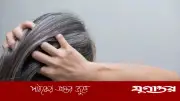 অকালে চুল পাকা রোধে ৪টি কার্যকরী খাবার