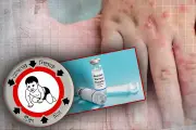 হামের প্রাদুর্ভাবে শিশুমৃত্যু বেড়েছে, টিকা দিতে অনীহা অভিভাবকদের