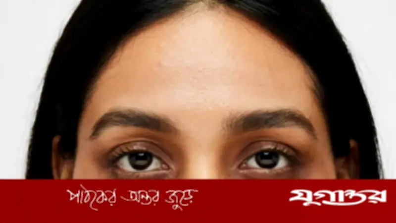 চোখের নিচে কালি পড়ার ৫ কারণ: শুধু ঘুমের অভাব নয়