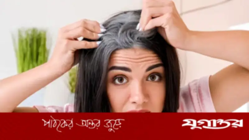 অল্প বয়সে চুল পাকছে? ঘরোয়া টোটকায় সমাধান