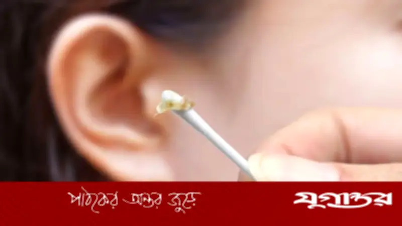 কানের ময়লার রং বলে দেবে স্বাস্থ্যঝুঁকির সংকেত