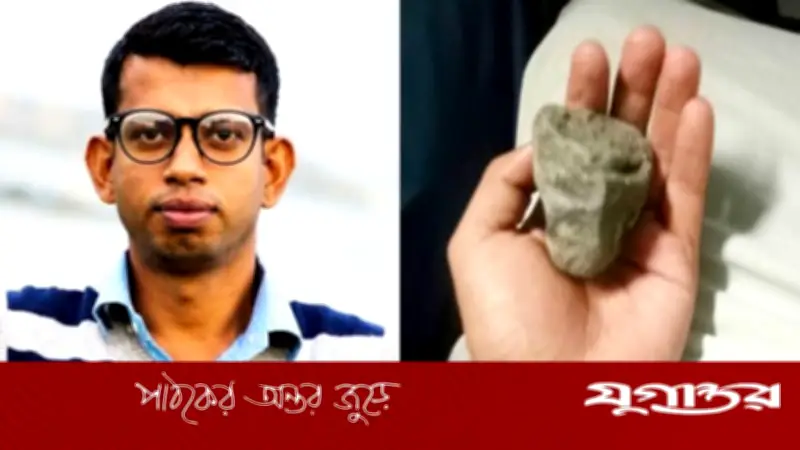 চলন্ত ট্রেনে পাথর নিক্ষেপে আইনজীবীর চোখ নষ্ট, দৃষ্টিশক্তি হারানোর শঙ্কা