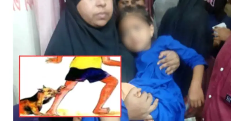 পটুয়াখালীতে পাগলা কুকুরের কামড়ে শিশুসহ ১০ জন আহত
