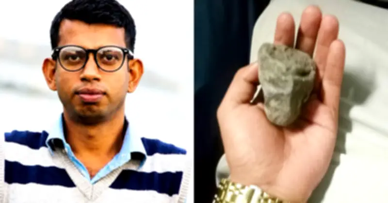 চলন্ত ট্রেনে পাথর নিক্ষেপ: আয়কর আইনজীবীর চোখ অপসারণ, আরেকজন আহত