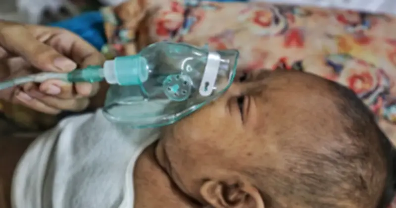 ২৪ ঘণ্টায় হামে আরও ৩ শিশুর মৃত্যু, মৃতের সংখ্যা ৬৮৩
