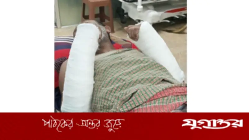 ভোলায় যুবলীগ নেতার হাত-পা ভাঙচুর, অভিযোগ বিএনপি-যুবদলের বিরুদ্ধে