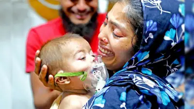 হামে আরও ৪ শিশুর মৃত্যু, মৃতের সংখ্যা ৬৫৬