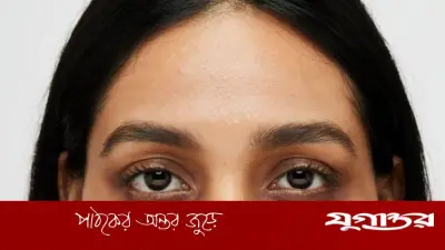 চোখের নিচে কালি পড়ার ৫ কারণ: শুধু ঘুমের অভাব নয়
