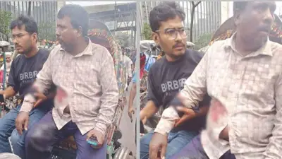 মতিঝিলে ব্যবসায়ীকে গুলি করে ১৭ হাজার ডলার ছিনতাই