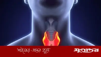 থাইরয়েড সমস্যার লক্ষণ ও প্রতিকার