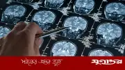 আলঝেইমার্স চিকিৎসায় নতুন আশা: ওএলই অণু মস্তিষ্কের রোগ প্রতিরোধ ক্ষমতা ফিরিয়ে আনতে সক্ষম
