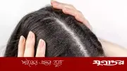 বর্ষায় খুশকি থেকে মুক্তি পেতে বদলে ফেলুন ৫ অভ্যাস